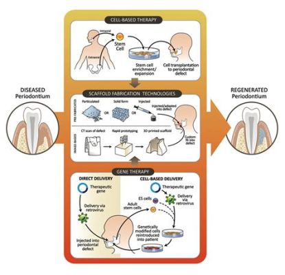  Vitrigel: Rivoluzione nella Ricostruzione Ossea e Terapia Cellulare